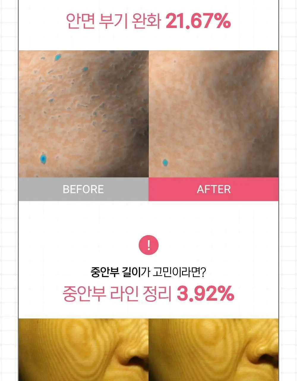 [추가2P증정] 닥터원더 피어싱 붓기 지압 귀침 (2종 중 택1) 상세페이지 24